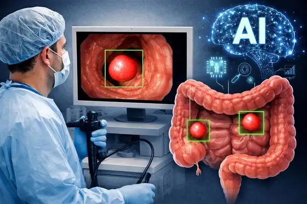 Yapay zeka kolonoskopide polip tespitini artırıyor